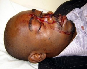 Report Cover photo: Nelson Chamisa's assailants used iron bars to beat him