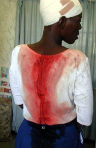 Report Cover Photo: Woman beaten by police during peaceful demonstration called by ZCTU on 18 November 2003: Bulawayo.