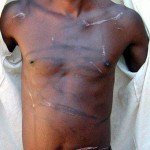 Report Cover Photo: Victim of violence, Presidential election campaign, Mberengwa East, January 2002 Report Cover Photo: Victim of violence, Presidential election campaign, Mberengwa East, January 2002